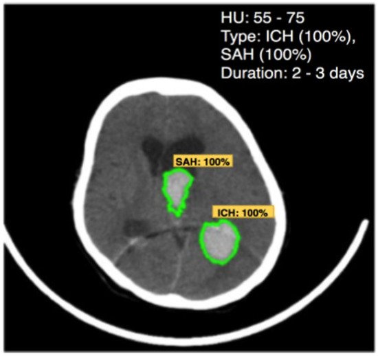 Applsci 12 04455 g015 550