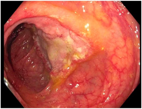 Pathogens 12 00694 g002 550