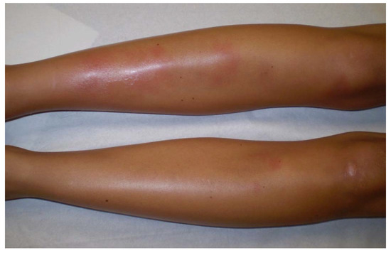 Cells 10 00766 g003 550