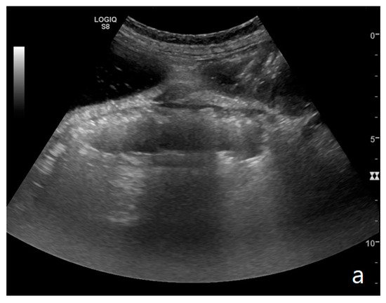 Diagnostics 11 00617 g005a 550