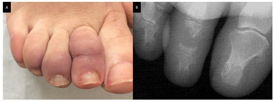 Cells 10 00766 g004 550