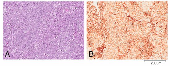 Cancers 13 01080 g001 550