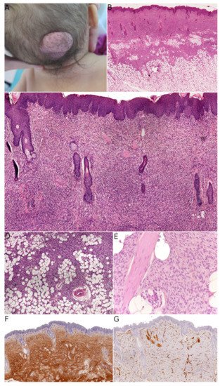 Dermatopathology 08 00035 g001 550