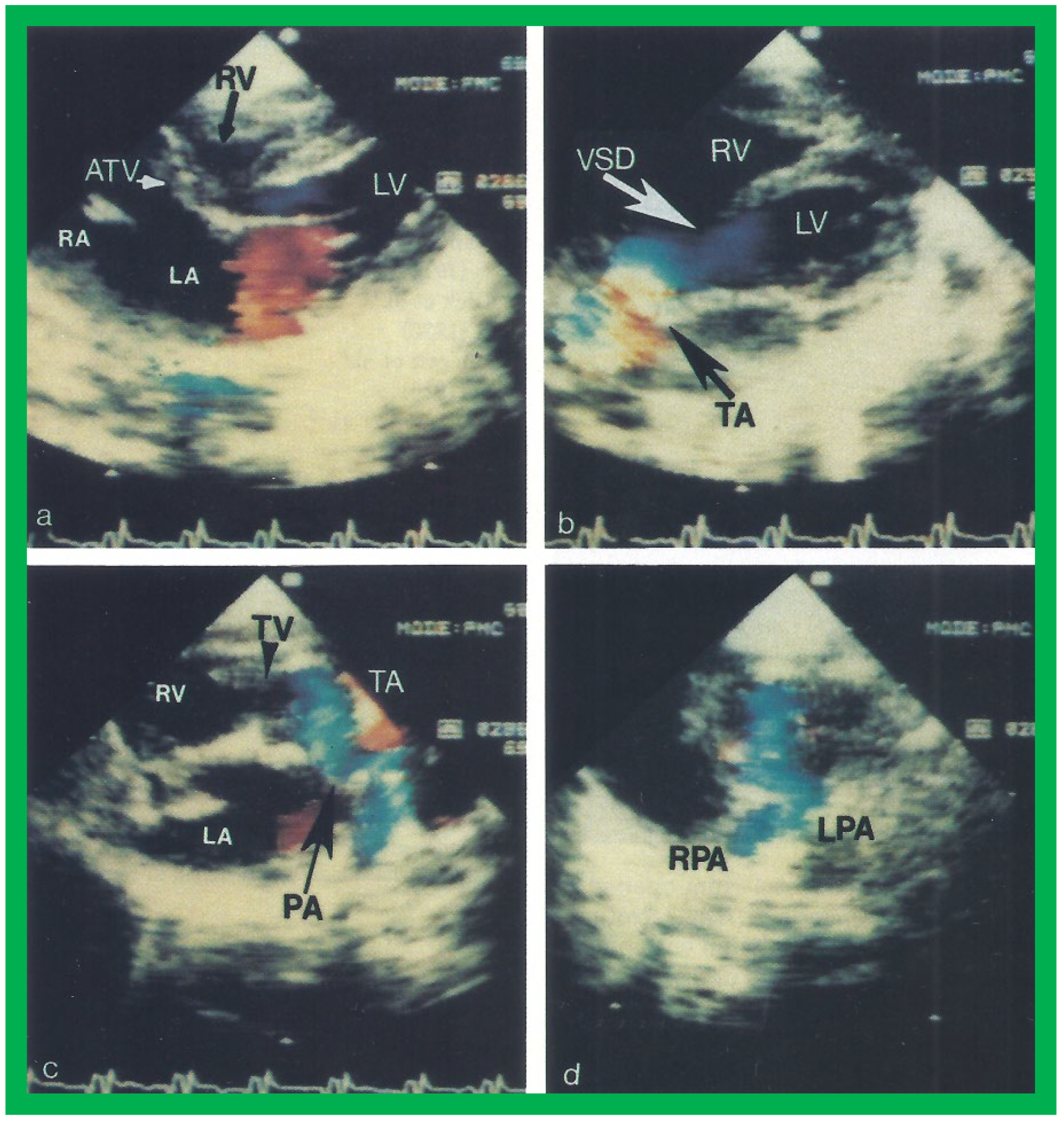 Applsci 11 09472 g014