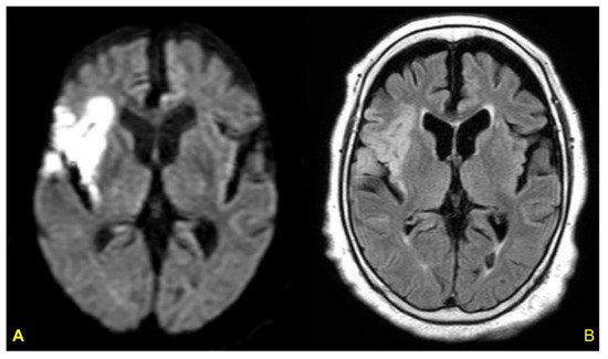 Biomolecules 12 00110 g006 550
