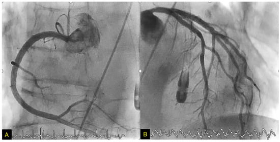 Biomolecules 12 00110 g007 550
