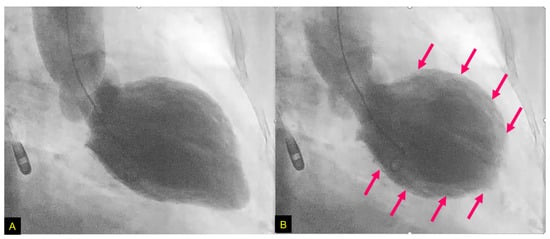 Biomolecules 12 00110 g008 550