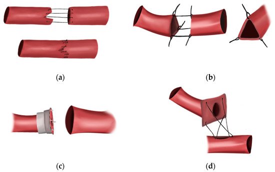 Bioengineering 09 00075 g001 550